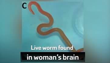 Eight centimeter long roundworm was pulled out alive from a woman's brain in Australia