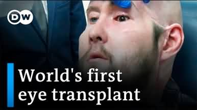 Surgeons perform world's first human eye transplant