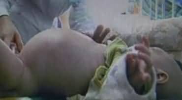 Two Years Child Got Pregnant in China - Two Small childs in his belly